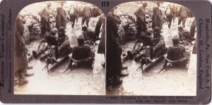 Keystone View Co. stereo Wounded WWI c1918
